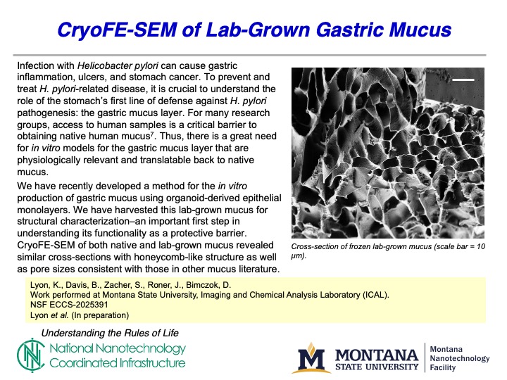 A slide detailing lab grown gastric mucus by Lyon and Bimczok